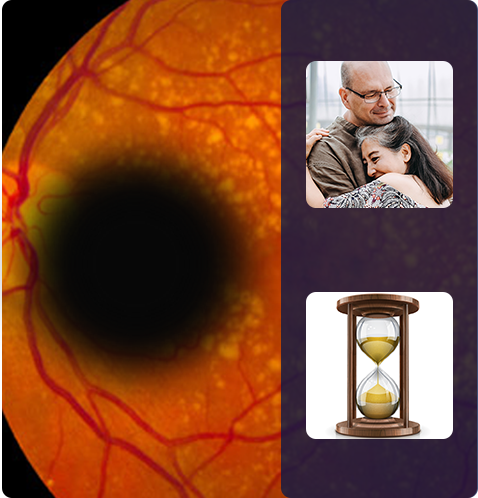Macula