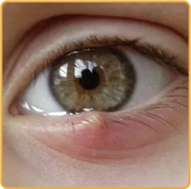 Ojo
